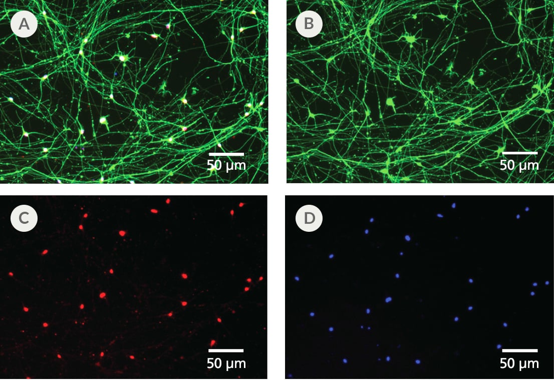 Fig 1 _ STEMdiffTM Forebrain Neurons