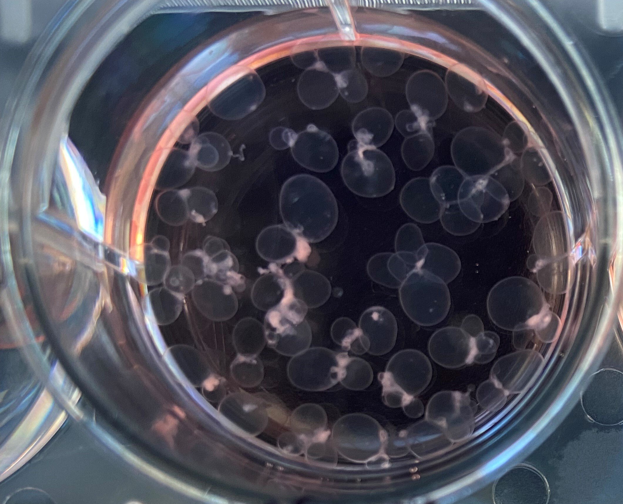 Fig 2 _ STEMdiffTM Choroid Plexus Organoids