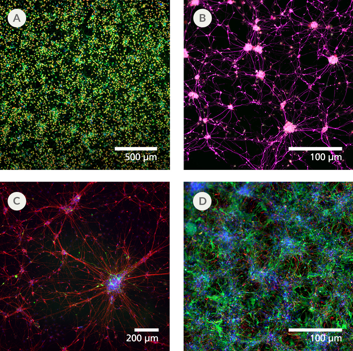 Fig 5 _ Human iPSC-Derived Forebrain Neuron Precursor Cells