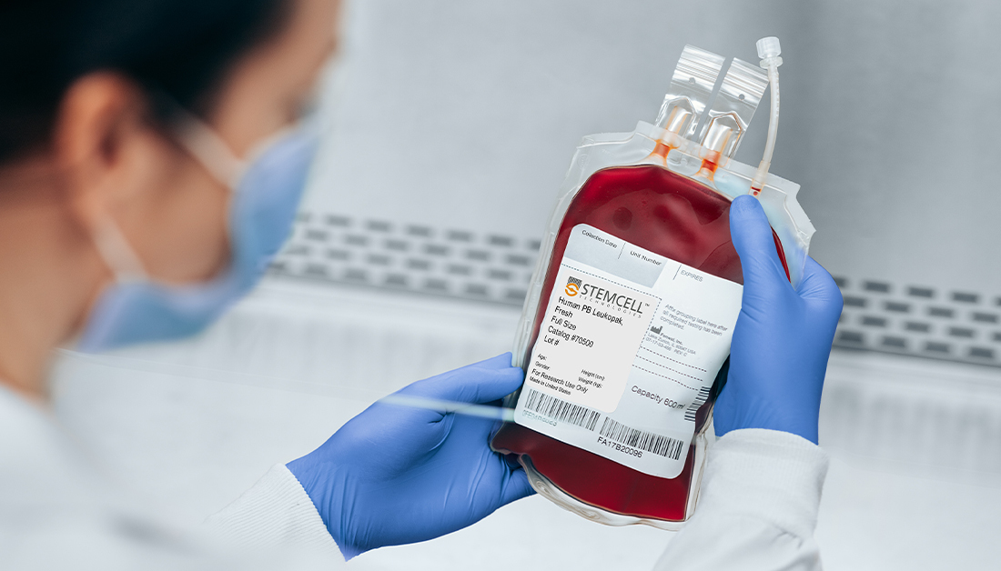 WEBLP665-ScienceExchange Blogpost Web Content-Leukopak-1100x628